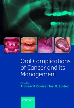 Oral Complications of Cancer and its Management