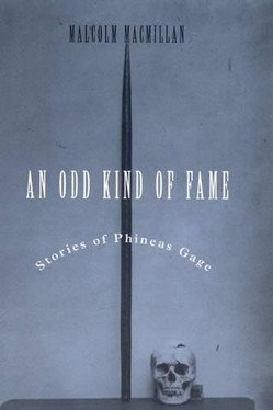 An Odd Kind of Fame