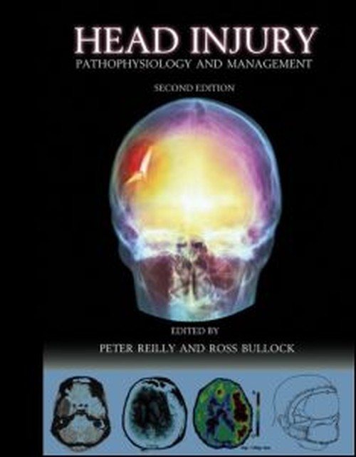 Head Injury 2Ed