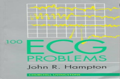 100 ECG Problems
