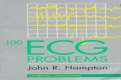 100 ECG Problems