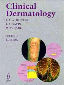 Clinical Dermatology