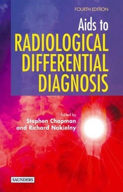 Aids to Radiological Differential Diagnosis