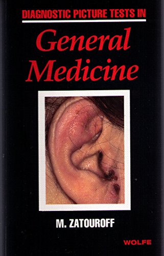 Diagnostic Picture Tests in General Medicine