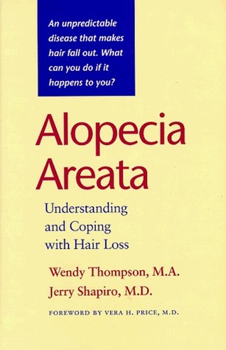 Alopecia Areata