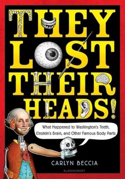 They Lost Their Heads!