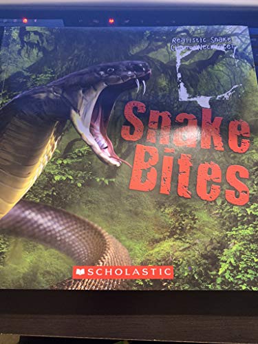 SNAKE BITES
