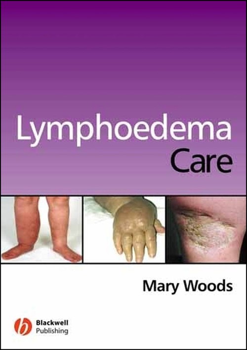 Lymphoedema Care
