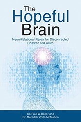 The Hopeful Brain