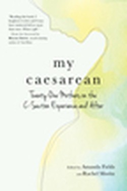 My Caesarean