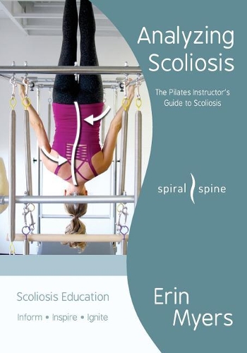 Analyzing Scoliosis