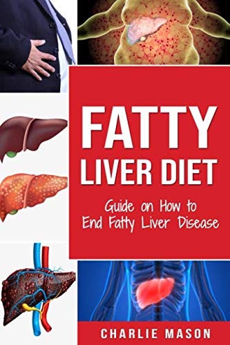Fatty Liver Diet: Guide on How to End Fatty Liver Disease: Fatty Liver Diet Books