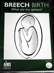 Breech Birth
