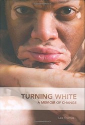 Turning White