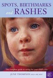 Spots, Birthmarks and Rashes