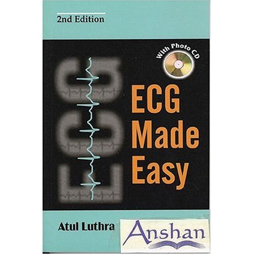 ECG MADE EASY