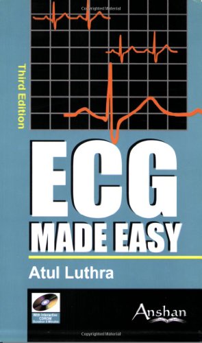 ECG Made Easy