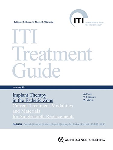 ITI Treatment Guide, Volume 10: Implant Therapy in the Esthetic Zone