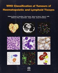 WHO classification of tumours of haematopoietic and lymphoid tissues