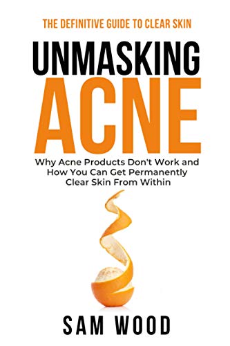 Unmasking Acne